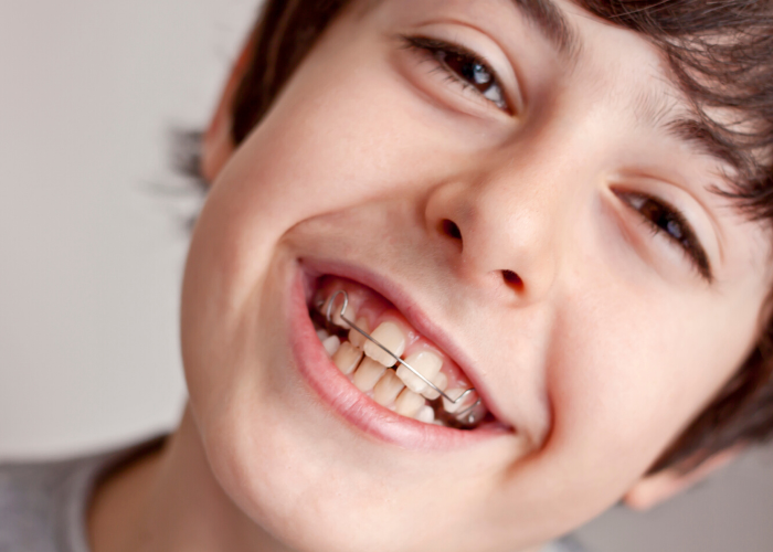 Orthodontist Boy with Retainer Kalamazoo Orthodontist